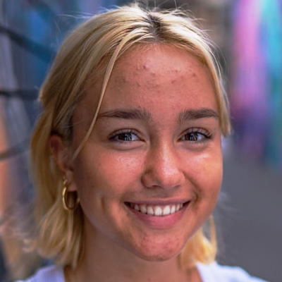 Verbesserung von Hautunreinheiten und Pickeln mit BeautyLight